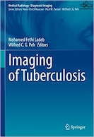 Imaging of Tuberculosis | تصویربرداری از سل